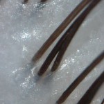 健康な頭皮