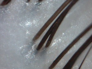 健康な頭皮