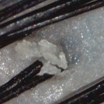 週に1度の頭皮クレンジングで毛穴の詰まりを取り除く