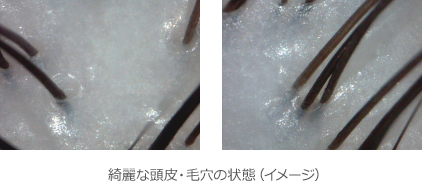 毛穴